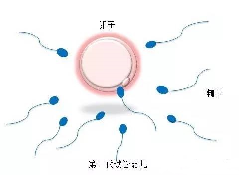 捐卵供卵咨询